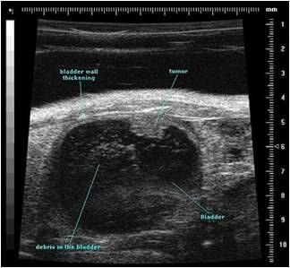 Ultrasound and photoacoustic imaging - Radboudumc